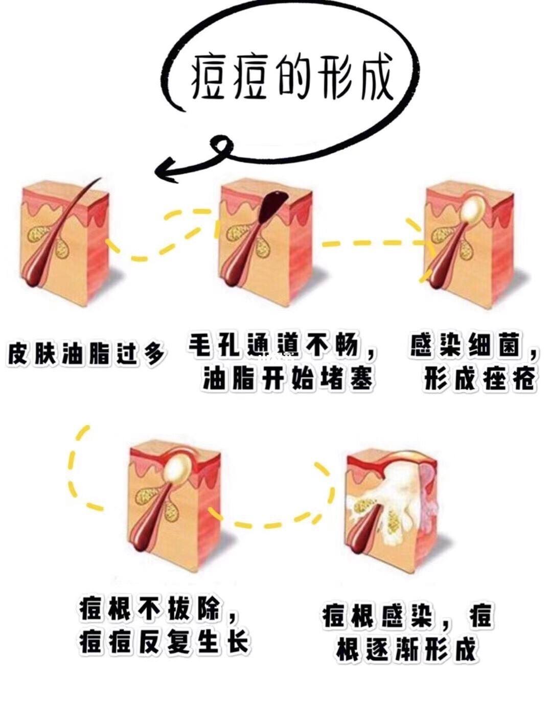 1646381595708288.jpg src=http___ci.xiaohongshu.com_d83d6ec8-fddc-72d7-e305-93a8d5191eff_imageView2_2_w_1080_format_jpg&refer=http___ci.xiaohongshu.jpg