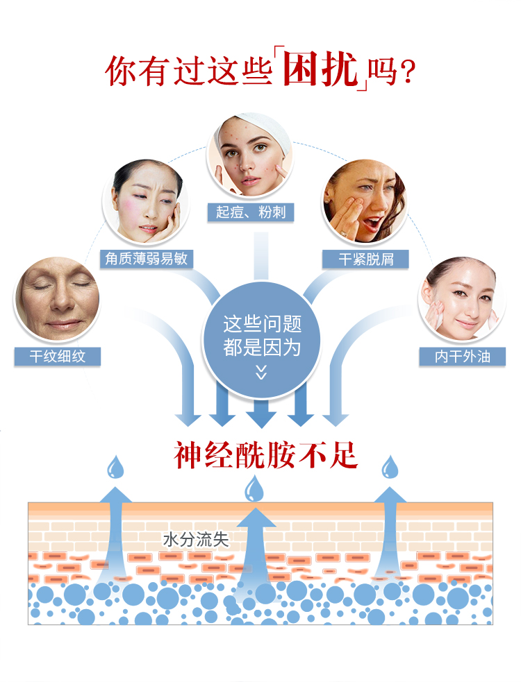 干性皮肤 干性皮肤